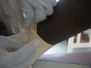 Pansement hydrocellulaire