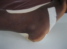 Pansement hydrocellulaire