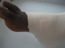 Pansement hydrocellulaire