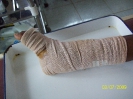Bandage de compression