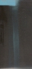 Radiographie d'ostéomyélite